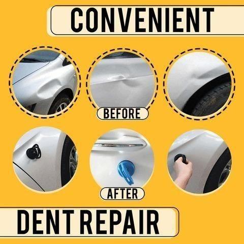 AutoGrip Dent Lifter